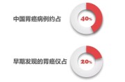 胃癌的症状、诊断、治疗，你该知道的都在这里