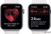 Apple Watch对于人体健康究竟有着多大的意义？