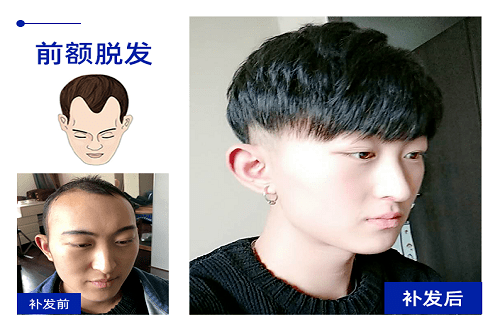 真发假发多少钱的好？影响假发价格的因素！