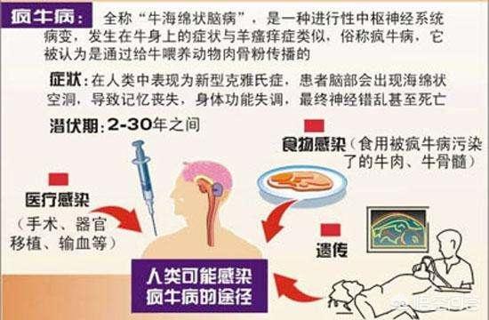 疯牛病最早发现于哪国？A印度B西班牙C英国？