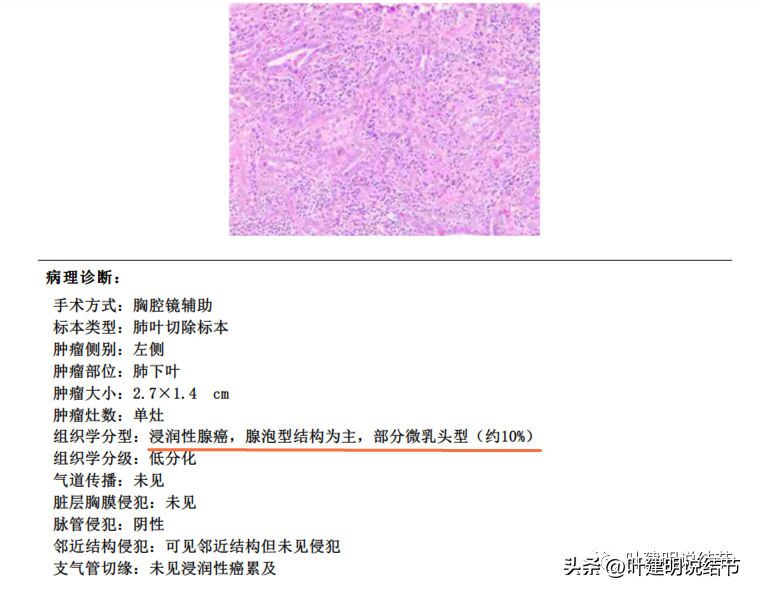 肺部玻璃密度结节_水玻璃密度_苯的密度密度比水