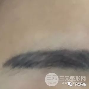 文一街小学 沈钱晟_文眉多少钱_多眉校园复仇文